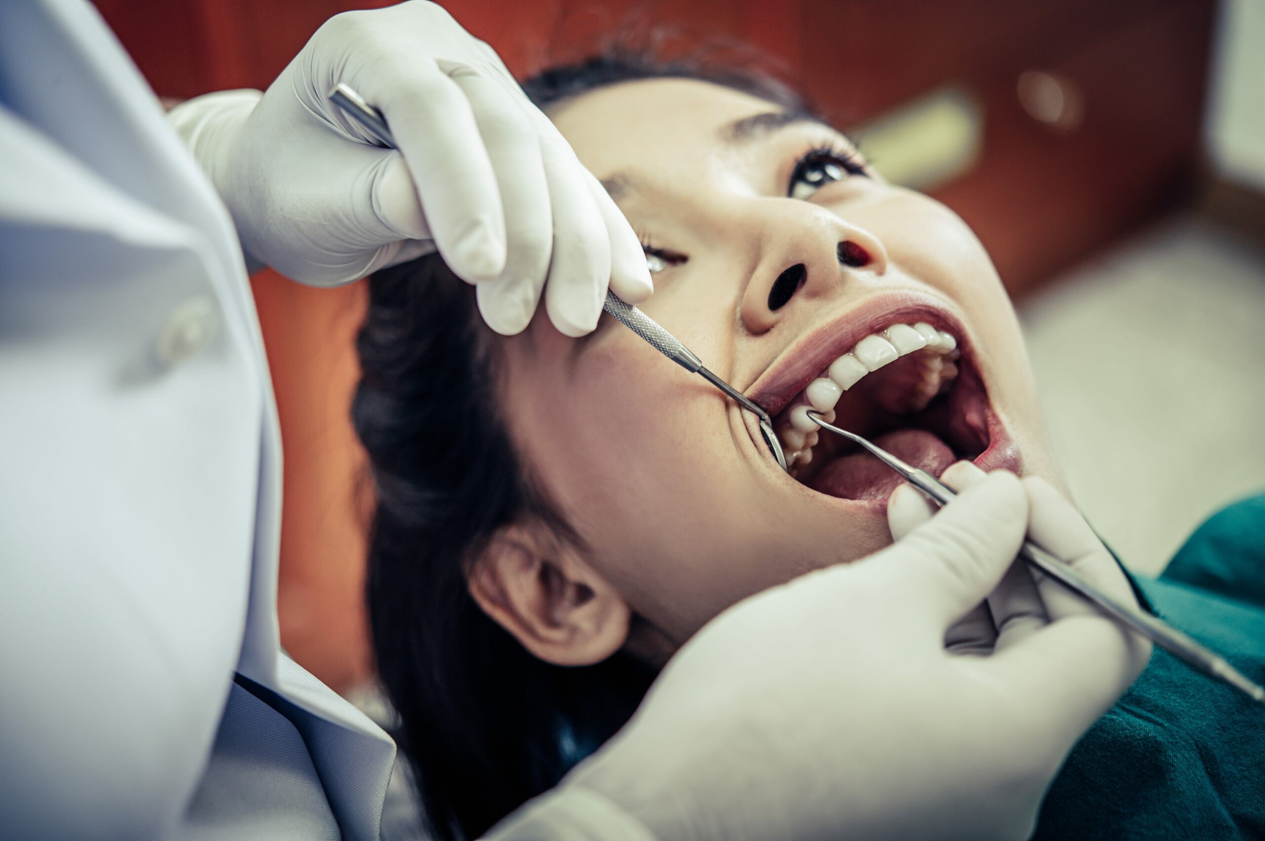 Dental Filling