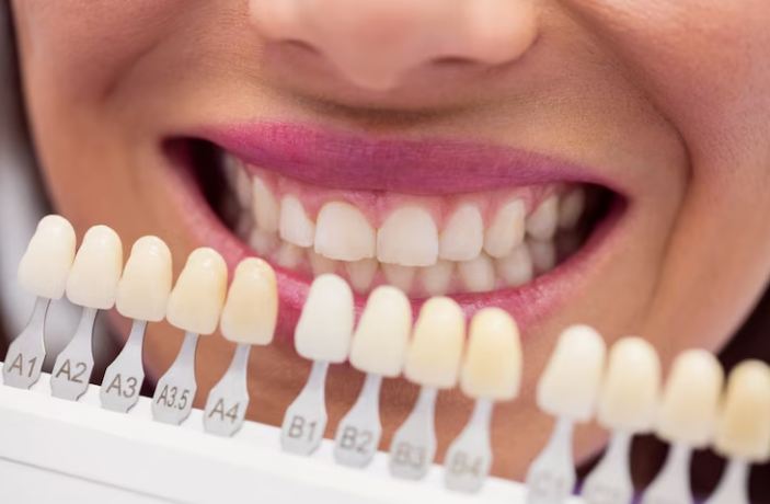 Image of healthy teeth