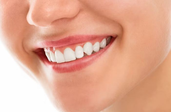 Image of healthy teeth