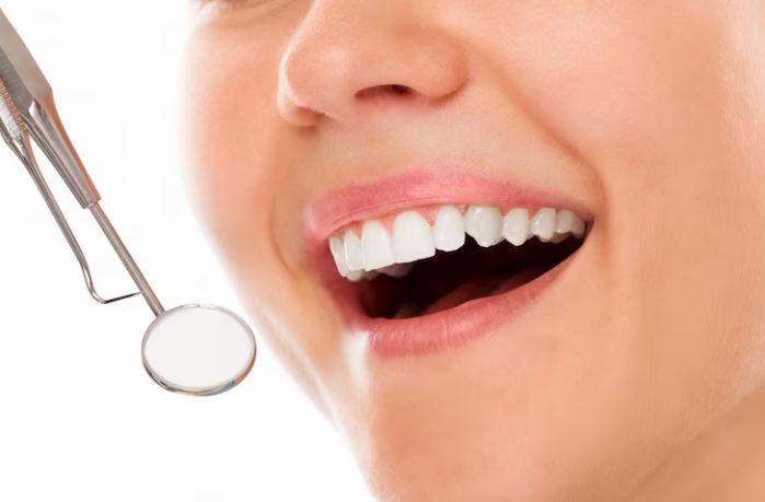 Image of teeth with dental veneers