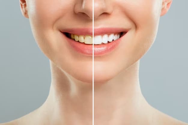 Before and after teeth whitening comparison