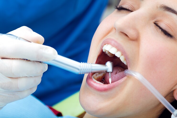Checkup dentist tool instrument