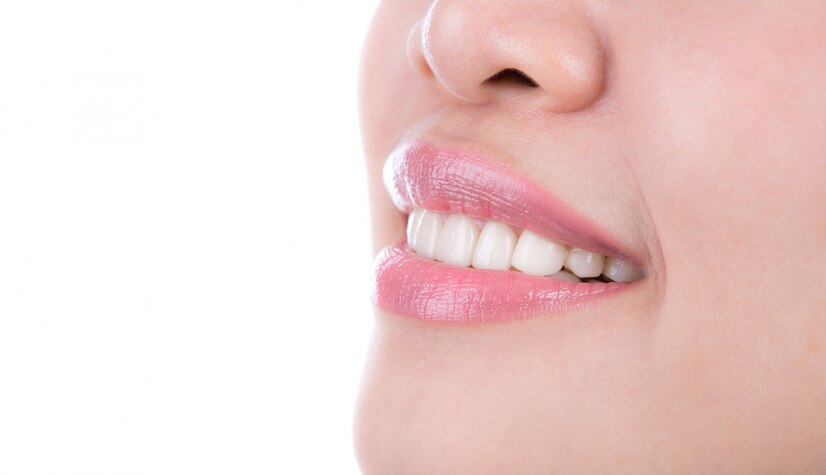 Image of healthy woman's teeth