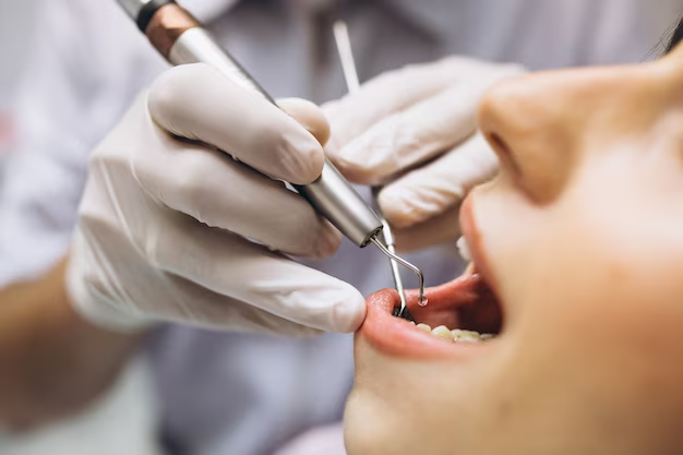 dental implants