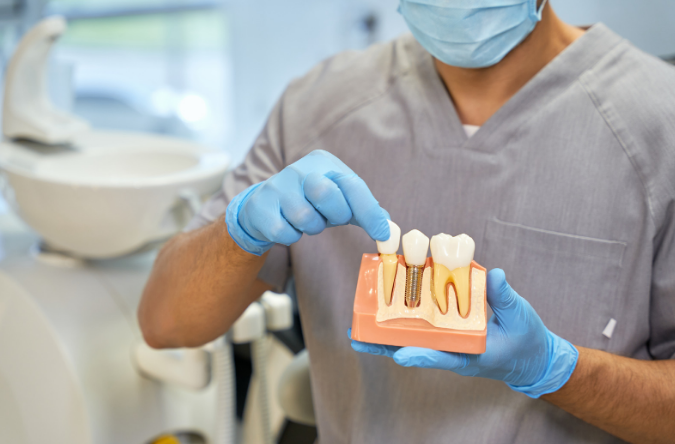 dental implants