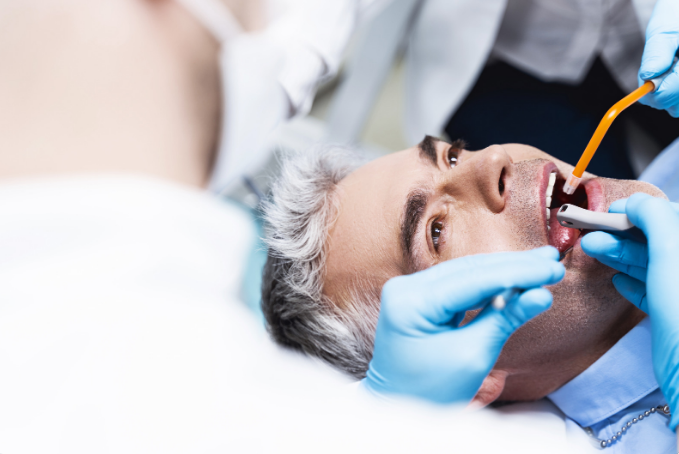 dental filling
