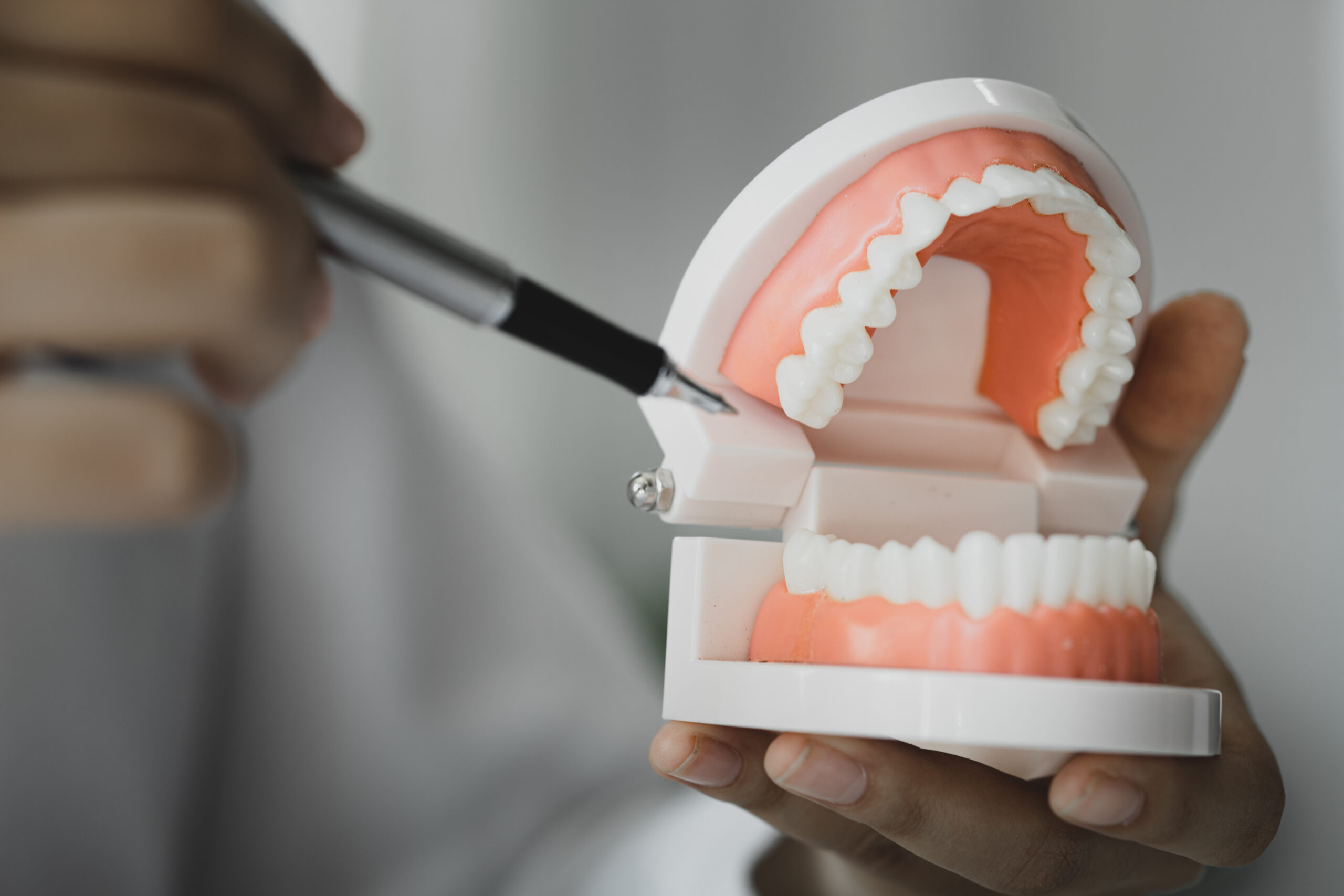 Dental implants