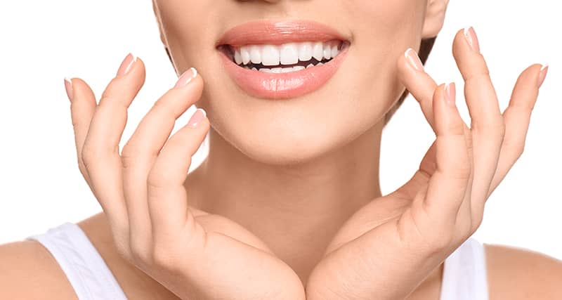 Hollywood smile