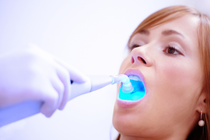 Dental Filling