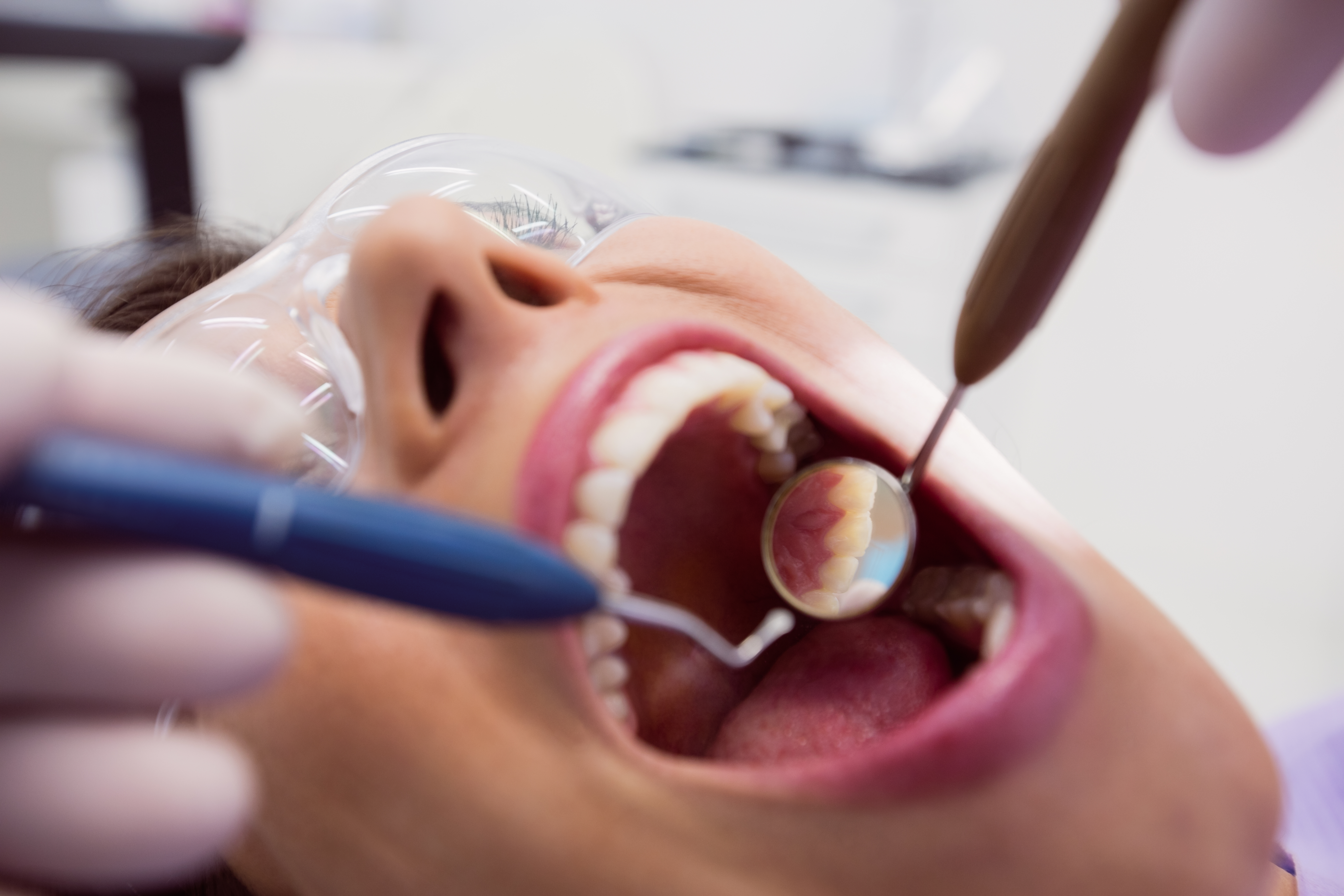 dental filling