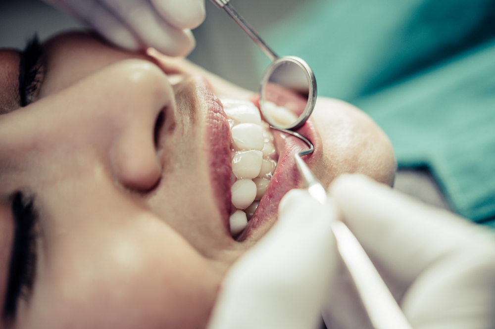 teeth whitening